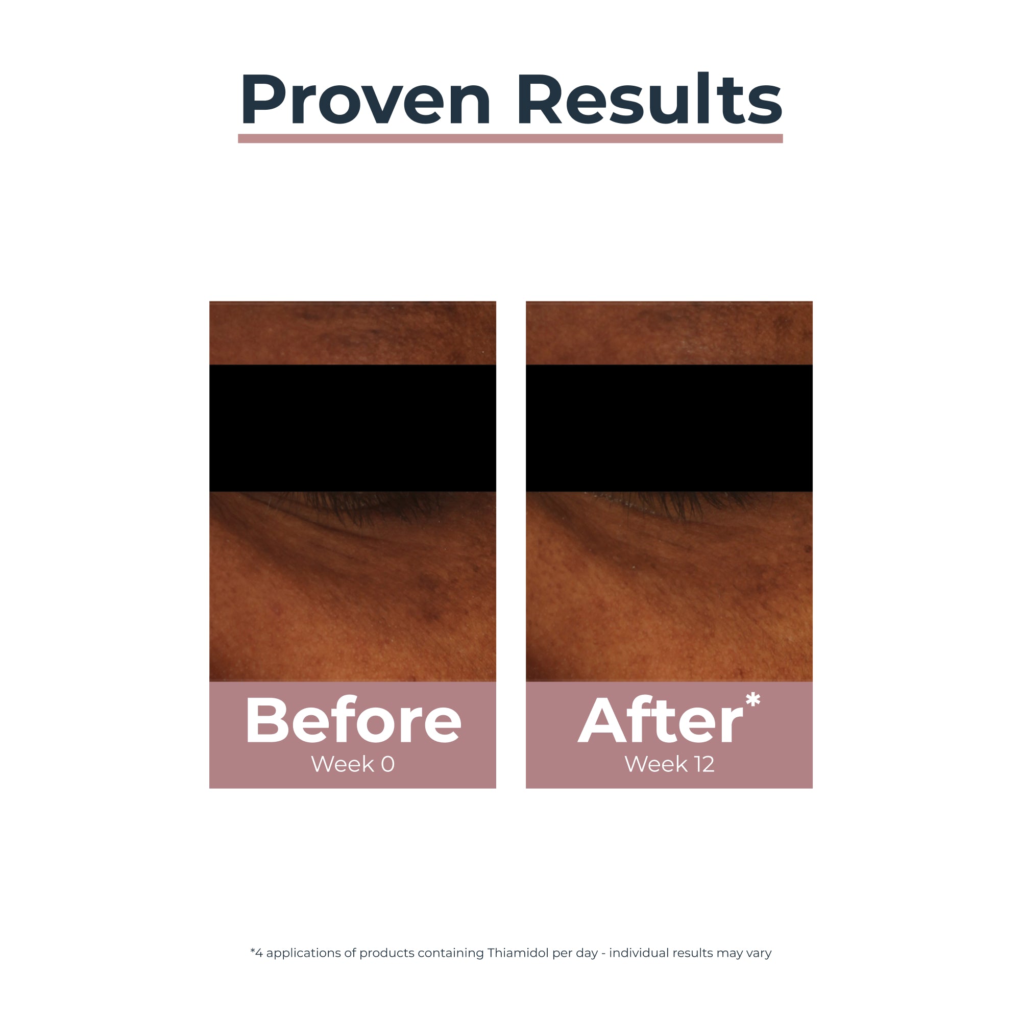 Eucerin Anti-Pigment Contorno de Olhos 15 ml