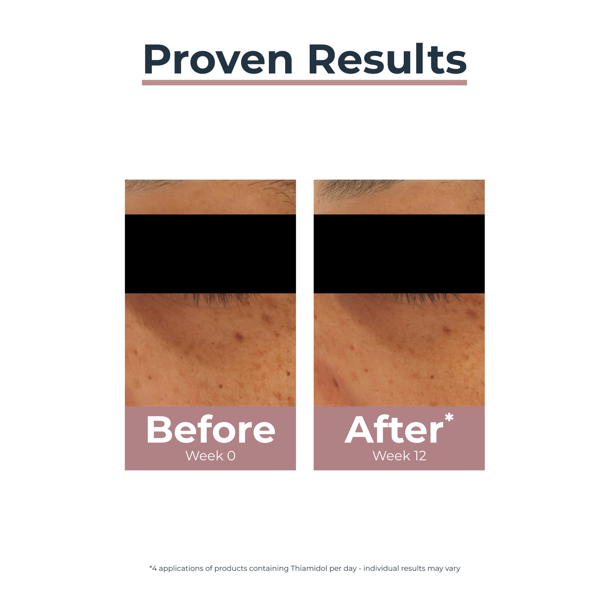 Eucerin Anti-Pigment Contorno de Olhos 15 ml