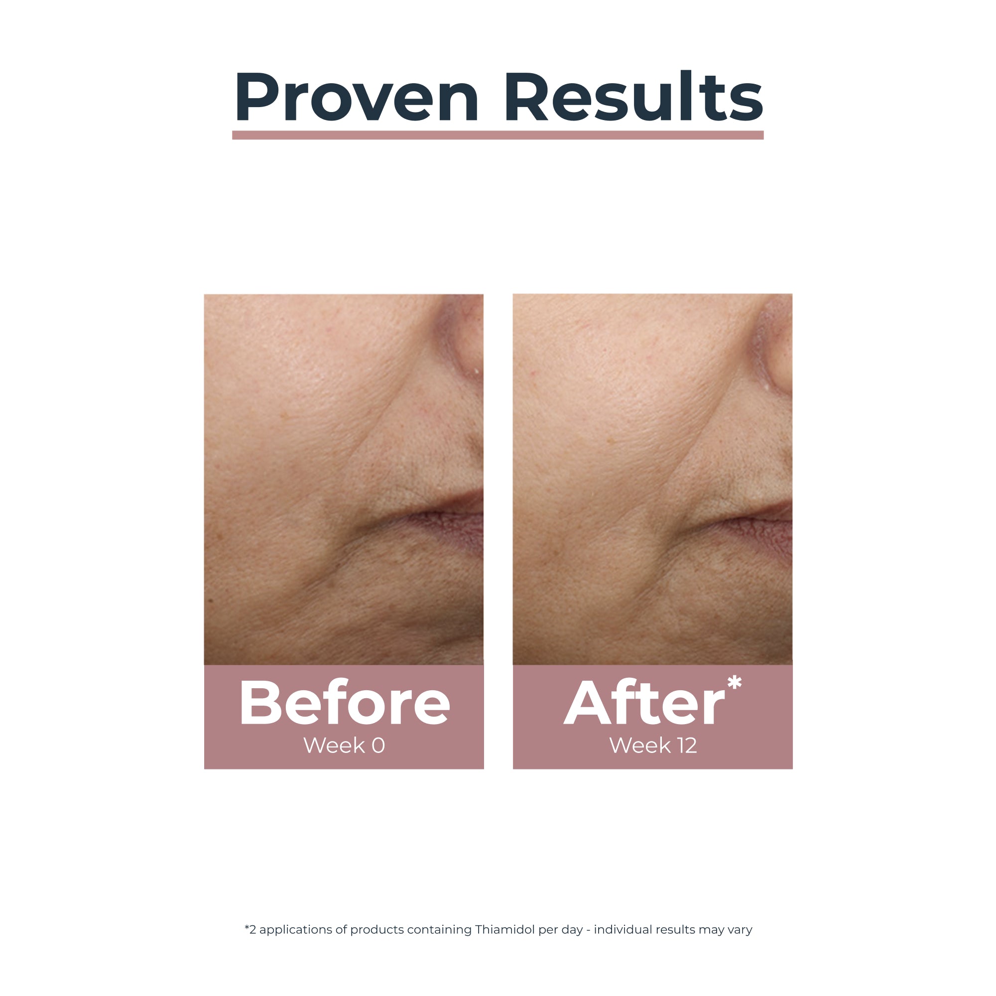 Eucerin Anti-Pigment Creme de Dia Médio FPS 30 50ml