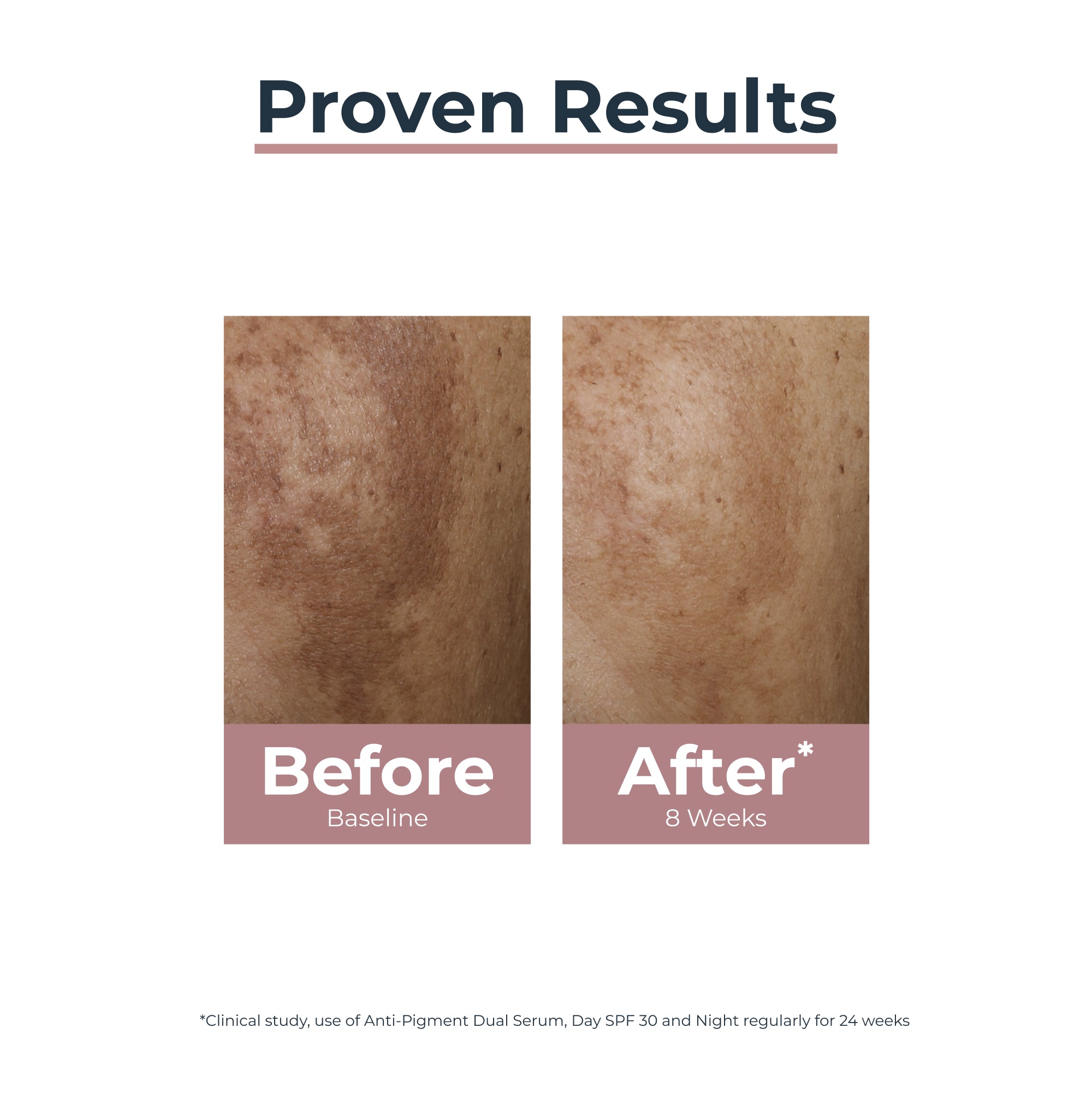 Eucerin Anti Pigment Pack