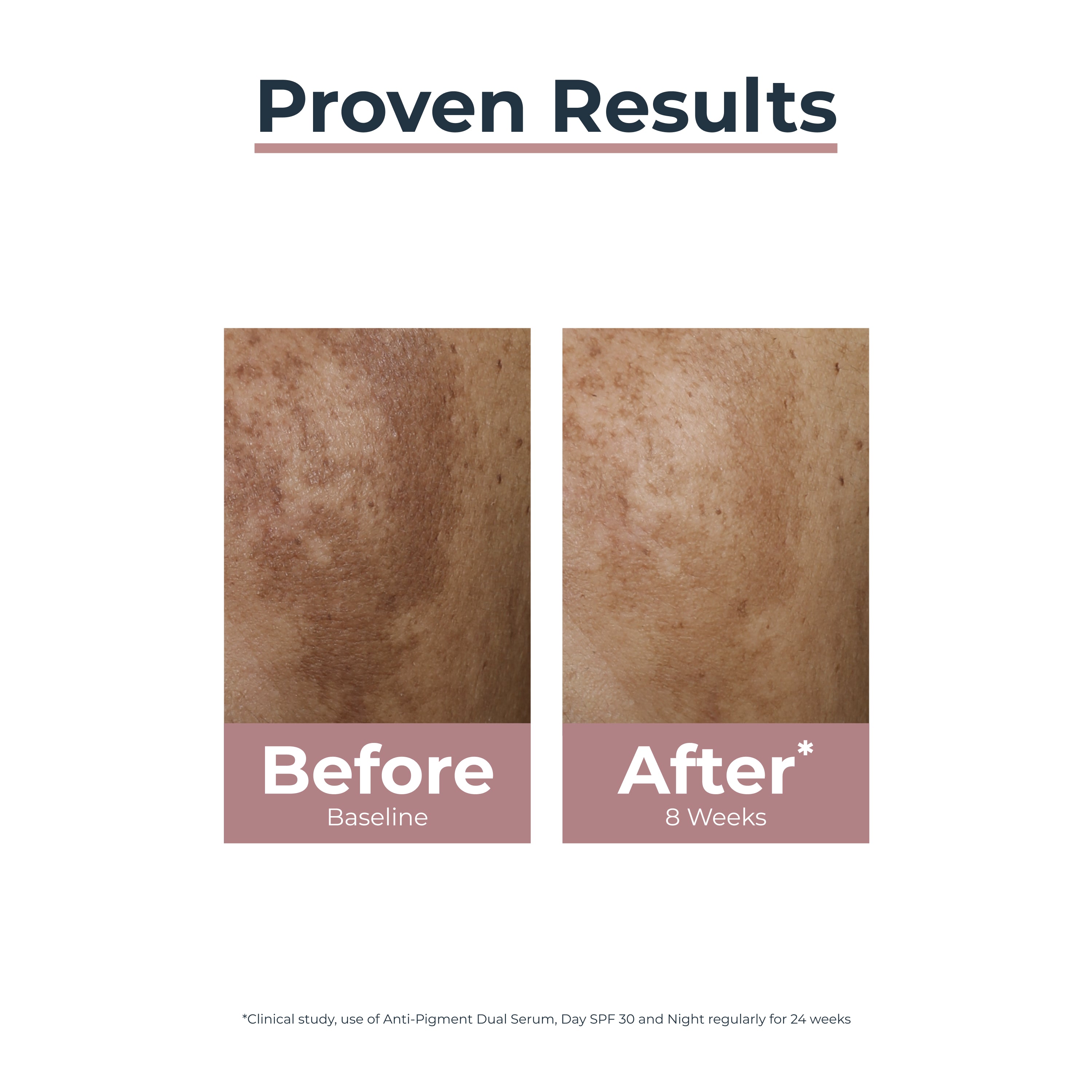 Eucerin Anti-Pigment Creme de Dia FPS 30 50ml