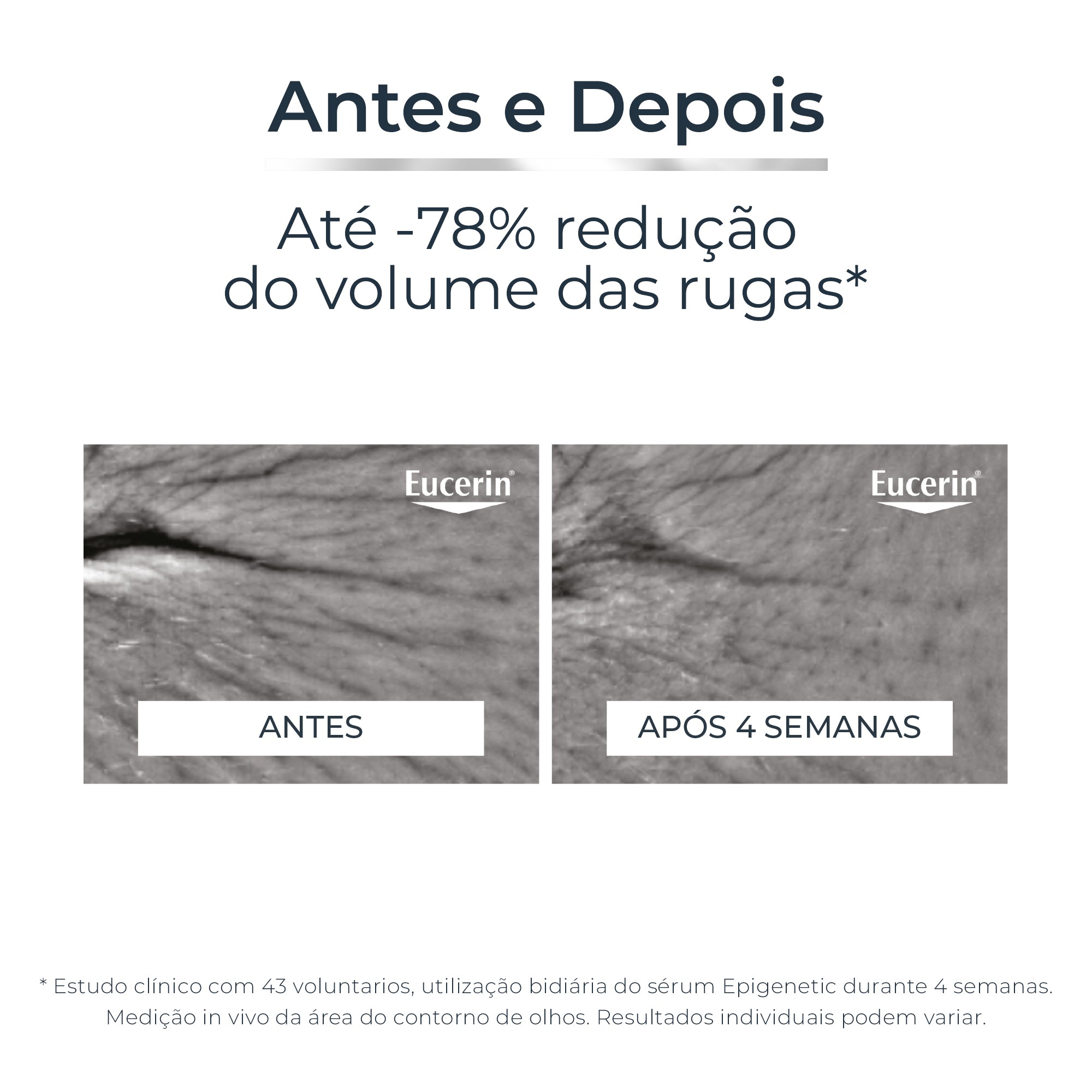 Eucerin Epigenetic Sérum 30ml