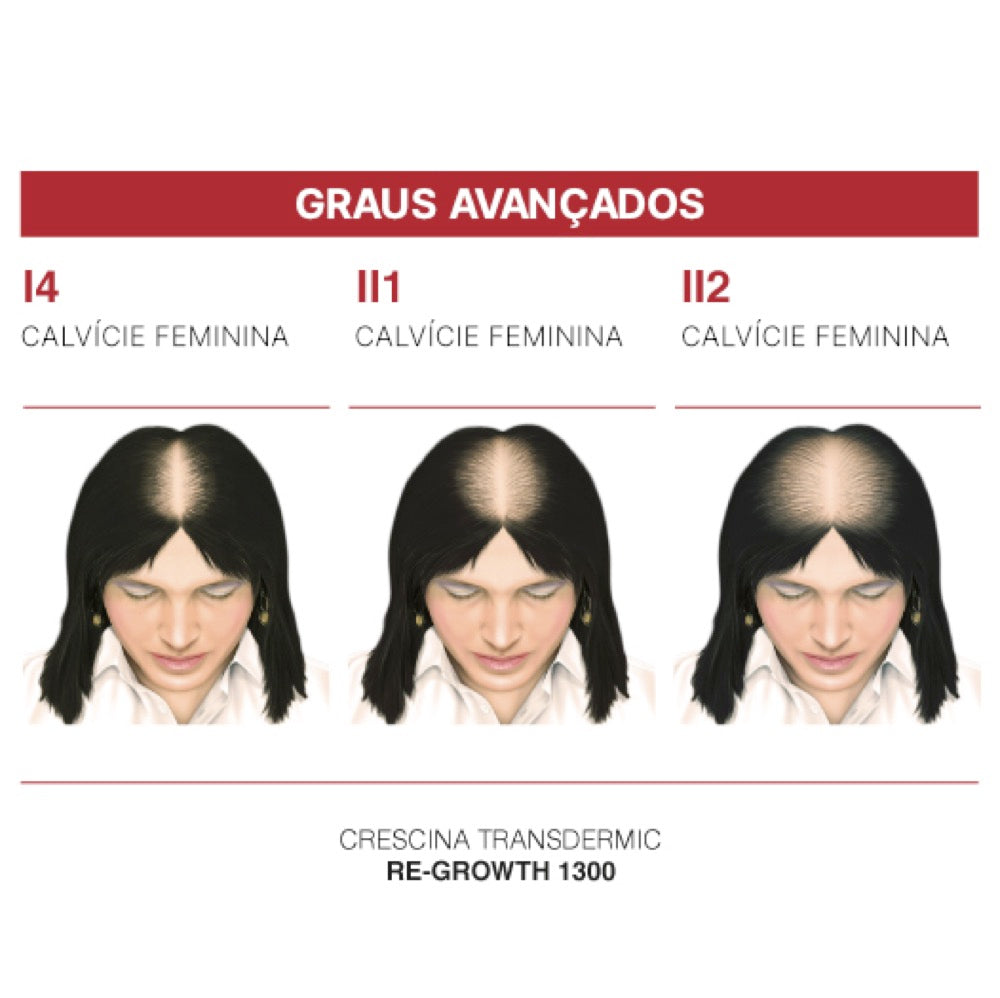 Crescina Transdermic HFSC Tratamento Completo 1300 Mulher 20 Ampolas 3.5 ml