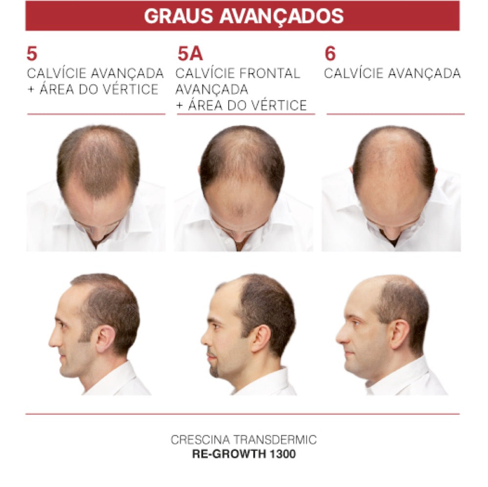 Crescina Transdermic HFSC Tratamento Completo 200 Homem 20 Ampolas 3.5 ml