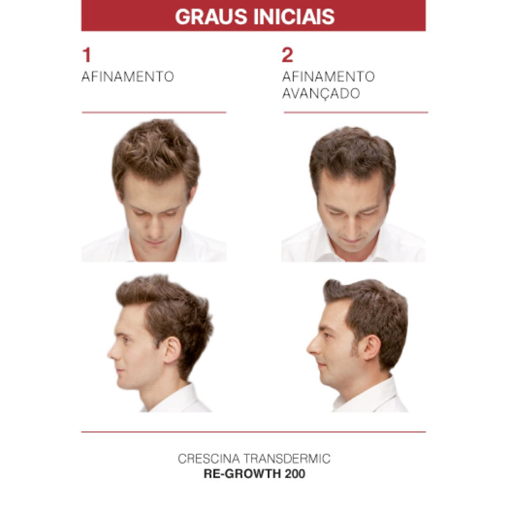 Crescina Transdermic HFSC Re-Growth 500 Homem 20 Ampolas 3.5 ml