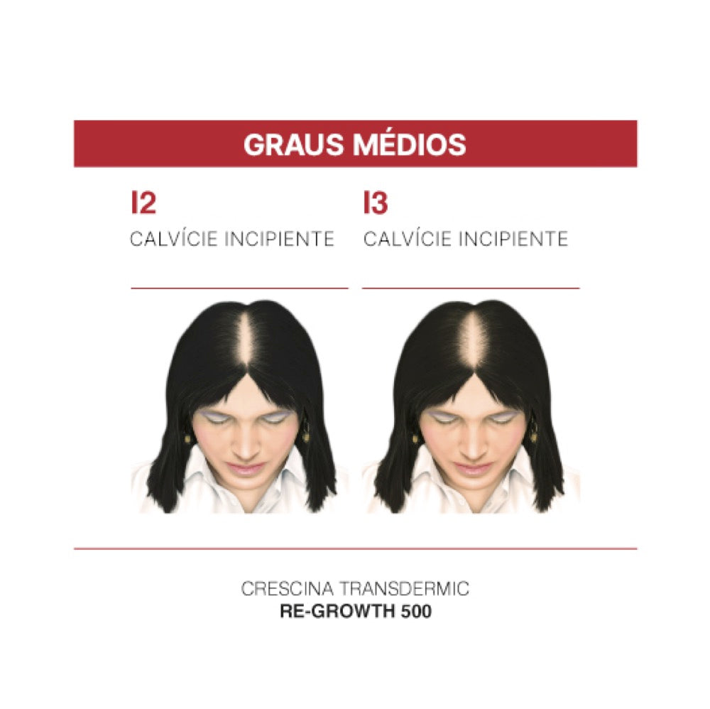 Crescina Transdermic HFSC Tratamento Completo 200 Mulher 20 Ampolas 3.5 ml