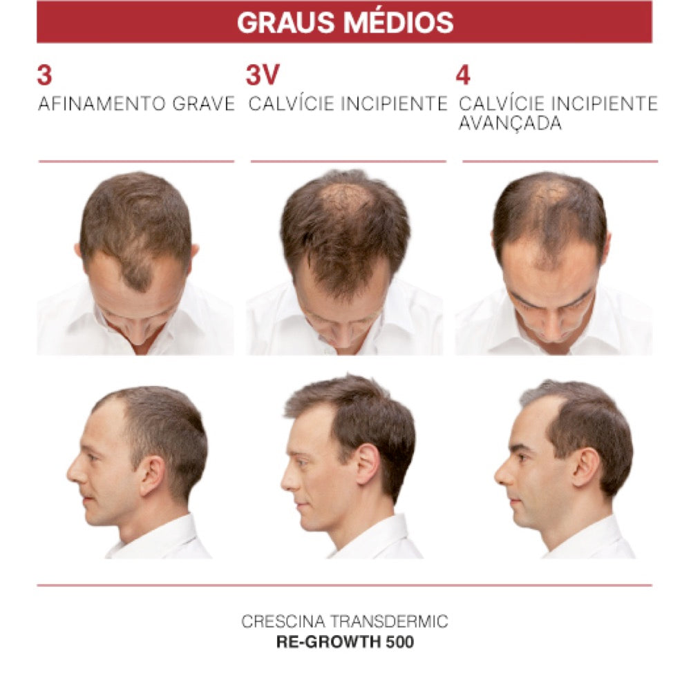 Crescina Transdermic HFSC Tratamento Completo 200 Homem 20 Ampolas 3.5 ml